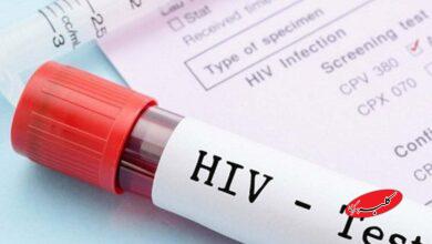 تست اچ آی وی - آزمایش اچ آی وی - HIV