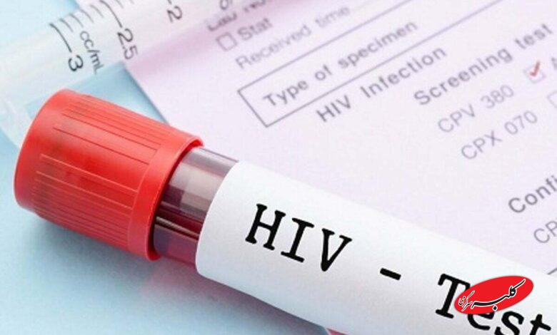 تست اچ آی وی - آزمایش اچ آی وی - HIV