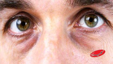 چشم پاندایی