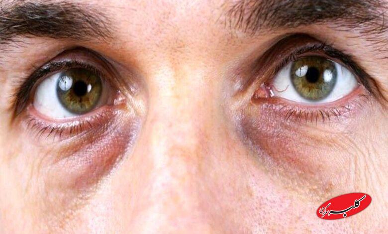 چشم پاندایی