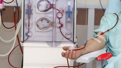 مهم ترین نوشیدنی برای پیشگیری از سنگ کلیه+فیلم