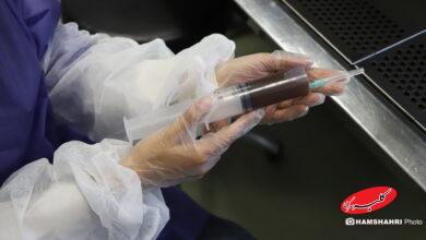 پیوند مدفوع