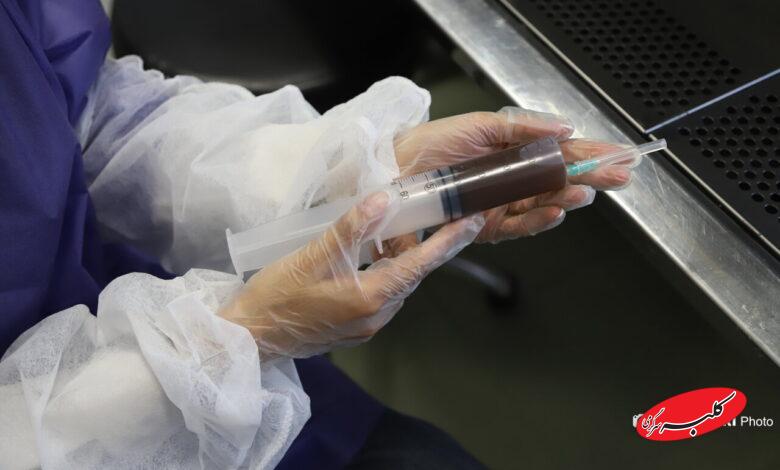 پیوند مدفوع