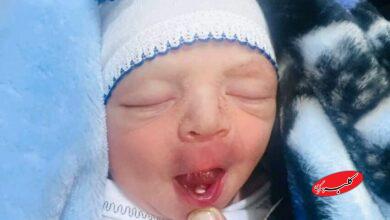 نوزاد عراقی با دندان به دنیا آمد