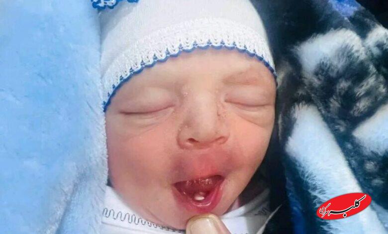 نوزاد عراقی با دندان به دنیا آمد