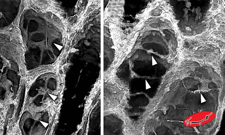 کشف فسیلی ۴۰۰ میلیونساله