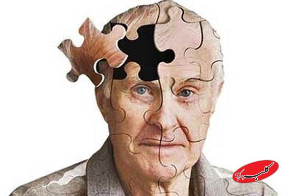 درمان سریع آسیب سر، خطر ابتلا به آلزایمر را کاهش میدهد