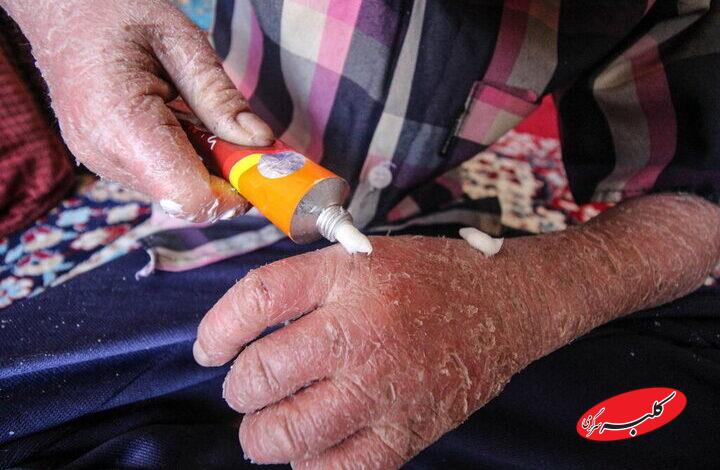 لزوم شفافیت بودجهای انجمنهای حمایت از بیماران