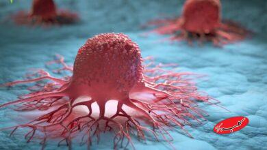 نجات جان زنان با یک آزمایش ساده؛ غربالگری از ۳۵ سالگی فراموش نشود