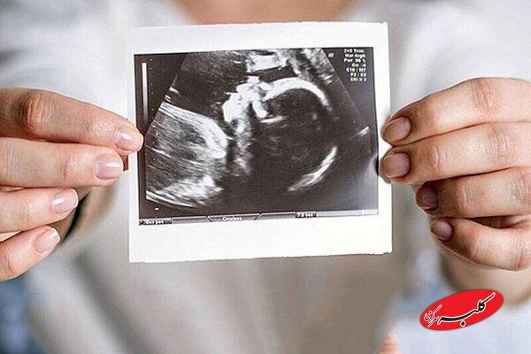 حمایت روانی، مهمترین عامل تداوم بارداری است