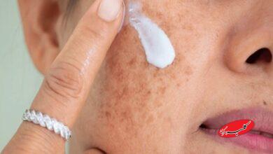 آلودگی هوا و پوست؛ چگونه از التهاب و خطر سرطان پیشگیری کنیم؟