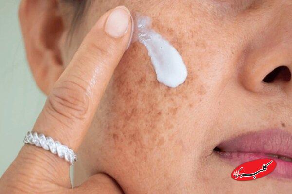 آلودگی هوا و پوست؛ چگونه از التهاب و خطر سرطان پیشگیری کنیم؟