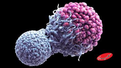 کشف مرگ سلولی میتواند به درمان سرطان کمک کند