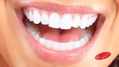 زیبایی لبخند بدون آسیب به دندان