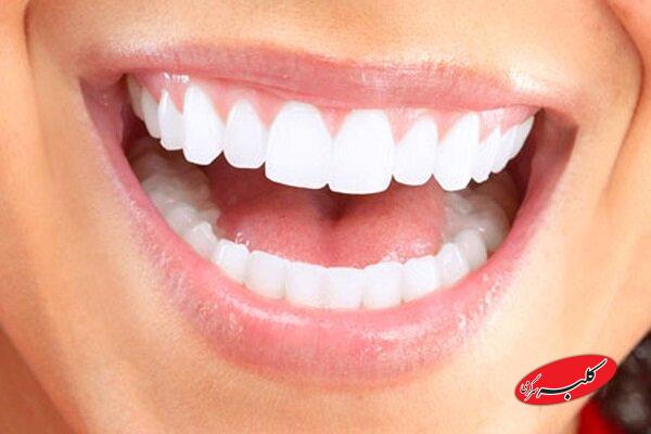 زیبایی لبخند بدون آسیب به دندان