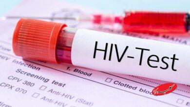 چه کسانی باید آزمایش «ایدز» بدهند