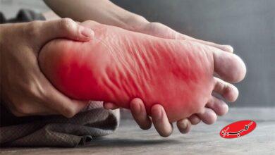 بیحسی و گزگز پا؛ نشانهای از مشکلات سیاتیک و ستون فقرات