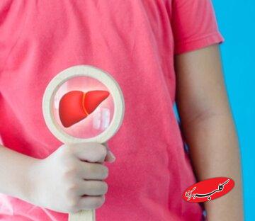 چگونه مبتلایان به کبد چرب دست از پرخوری بردارند؟