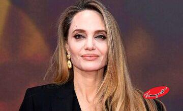 خودافشاگری شجاعانه بازیگر زن از زخمهای بدنش