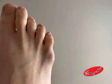 وظیفه بزرگِ انگشت کوچک پا / اگر نباشد چه میشود؟
