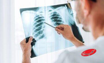 چرا آنفلوآنزا گاهی کشنده میشود؟