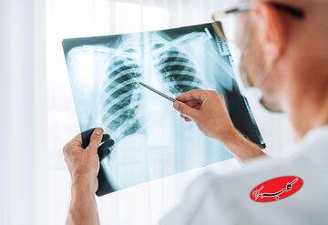 چرا آنفلوآنزا گاهی کشنده میشود؟