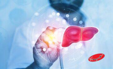 ۵ علامت روی صورت که نشان میدهد کبدتان چرب است