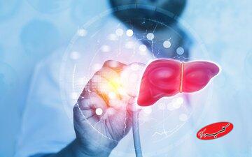 ۵ علامت روی صورت که نشان میدهد کبدتان چرب است