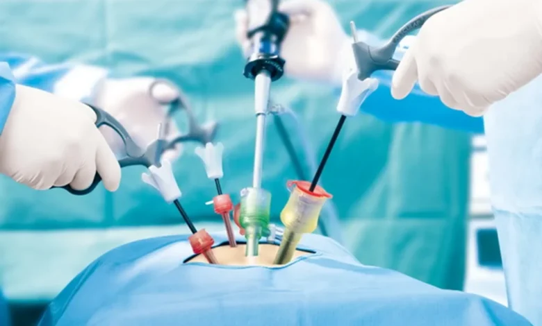 لاپاراسکوپی