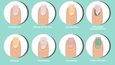 مشکلات مختلف ناخن