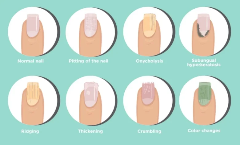 مشکلات مختلف ناخن