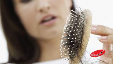 برای افزایش رشد مو چه خوراکیهایی را مصرف کنیم؟
