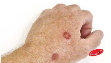 هشدار جدی نسبت به استفاده از مواد آرایشی غیراستاندارد