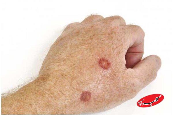 هشدار جدی نسبت به استفاده از مواد آرایشی غیراستاندارد