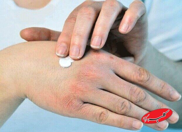 راهکارهای طب ایرانی برای حفظ سلامت پوست و بدن در فصل سرد