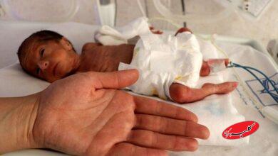 ترخیص نوزاد ۷۰۰ گرمی پس از ۴۸ روز تلاش شبانهروزی کادر درمان