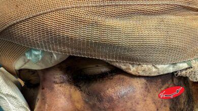 رد خون تروریسم روی «سلامت»؛ هدف از حمله به آمبولانسها چیست؟