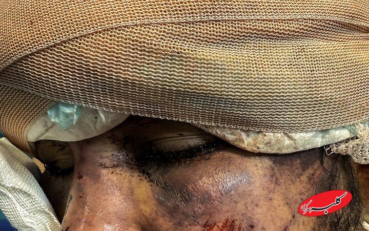 رد خون تروریسم روی «سلامت»؛ هدف از حمله به آمبولانسها چیست؟