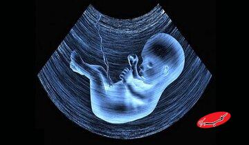 احکام شرعی | راههای جبران شرعی سقط عمدی چیست؟