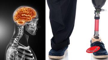 ماجرای مردی که از پزشکان خواست دو انگشتش را قطع کنند