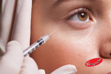 تزریق غیرحرفهای بوتاکس چه عارضهای دارد