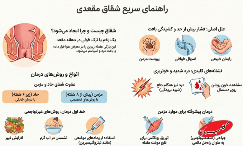 شقاق مقعدی