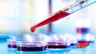 آزمایش خون میتواند بیماری کرون را پیشبینی کند