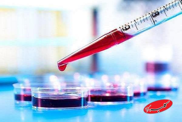 آزمایش خون میتواند بیماری کرون را پیشبینی کند