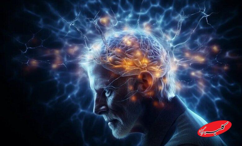 آلزایمر