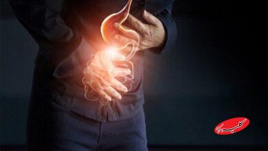 مدیریت رفلاکس در ماه رمضان؛ افطار سبک، معده سالم