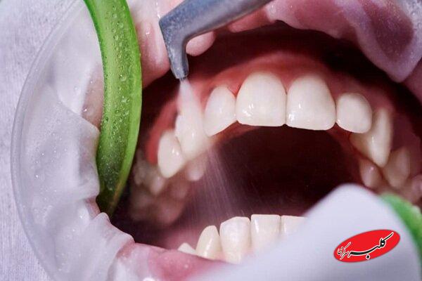جرمگیری، راهی موثر برای پیشگیری از پوسیدگی و بیماری لثه