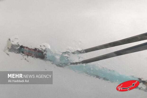 فریز جنین چیست و برای چه کسانی توصیه میشود؟