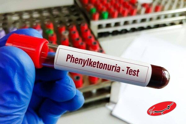 خبر خوش برای بیماران PKU؛ توزیع نان فاقد پروتئین