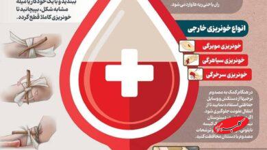 ببینید: چطور خونریزی را کنترل کنیم؟